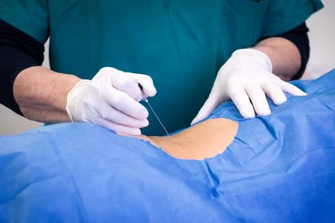Infiltration for lumbar hernia Stock Photos