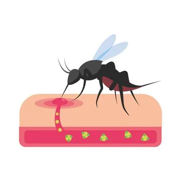 Inflamed dengue mosquito bite Stock Illustration