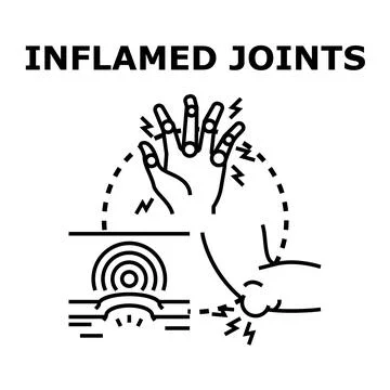 Inflamed joints causing pain and discomfort vector illustration Illustrazione stock