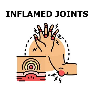 Inflamed joints causing pain and discomfort vector illustration Illustrazione stock