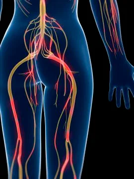 Inflamed nervous system, artwork Stock Illustration
