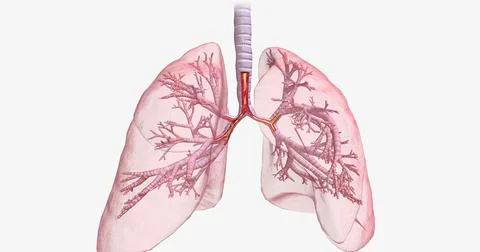 Inflammation and constriction of airways Stock Illustration