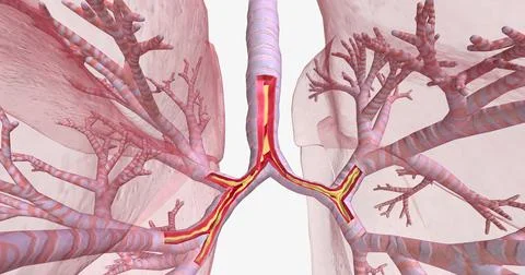 Inflammation and constriction of airways Stock Illustration