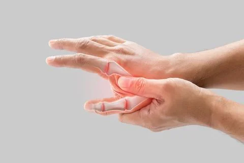 Inflammation of the finger bone. Stock Photos