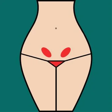 Inflammation of ovaries Stock Illustration