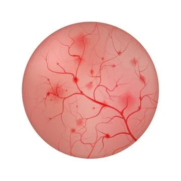 Inflammation of the urinary bladder Stock Illustration
