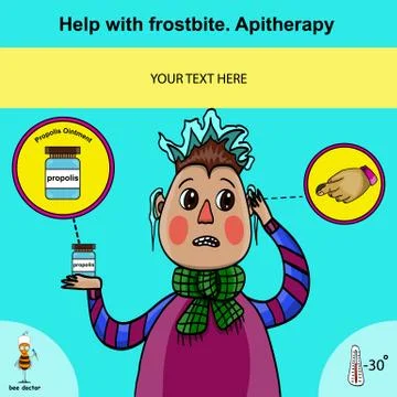 Information poster about first aid for frostbite using apitherapy Stock Illustration