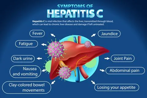 Informative Symptoms of Hepatitis C Stock Illustration