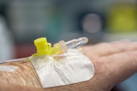 Infusion given into hand Stock-Fotos