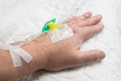 Infusion given into hand Foto stock