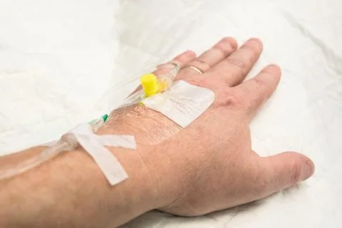Infusion given into hand Stock Photos