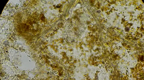 Infusoria feeding under microscope Видео 33661699