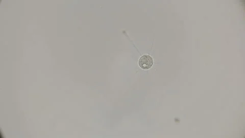 Infusoria Podophrya under a microscope Stock Footage 90234242