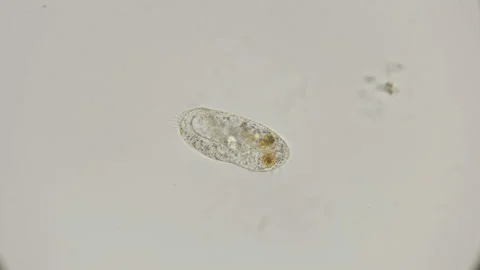 infusoria-shoe-under-microscope-footage-089458196_iconl.jpeg