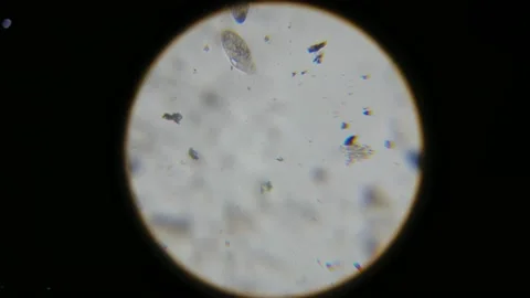 Infusoria slipper view in a microscope, selective focus. Stock Footage 231571701