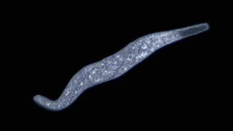Infusoria Spirostomum sp. under microscope, Class Heterotrichea Stock Footage 160358849