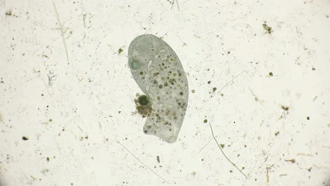 Infusoria Stentor coeruleus under the microscope Stock Footage 90320369
