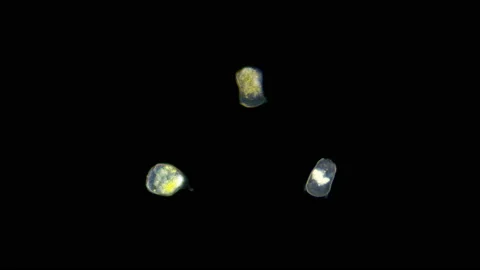 Infusoria Vorticella under the microscope, class Oligohymenophorea. Stock Footage 143641999
