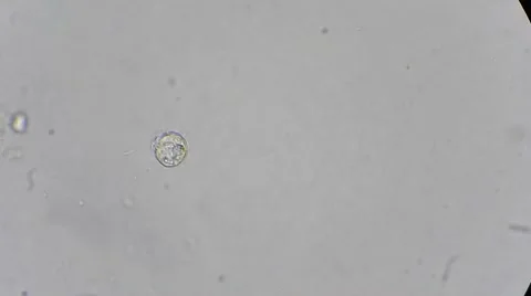 Infusoria2cut - Сегмент1(00 00 00.000-00 00 20.747) Stock-Footage 45597685