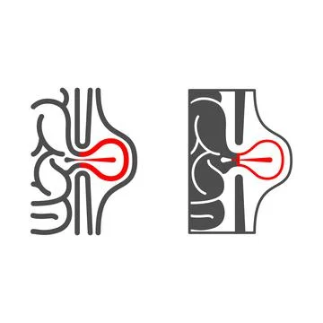 Inguinal hernia line and solid icon, Human diseases concept, hernia sign on Stock Illustration