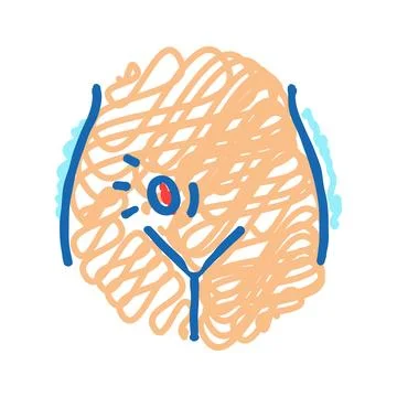 Inguinal herniorrhaphy surgery icon doodle illustration Illustrazione stock