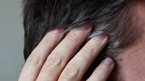 The initial stage of gray hair. The problem of gray hair in men. Stock Footage 301656381