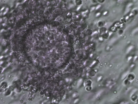 Injecting the sperm cells into the uterus during the medical IVF procedure Stock Footage 256042832
