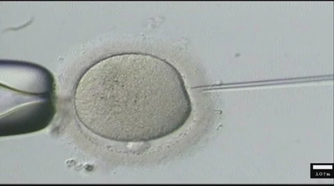 Injecting sperm into a woman Stock Footage 65263129