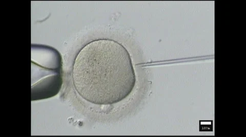 Injecting sperm into a woman's eggs to IVF Stock Footage 35917227