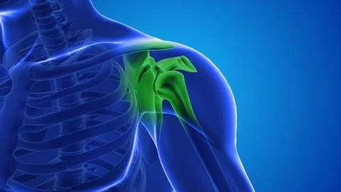 Injecting stem cells into a human shoulder Stock Illustration