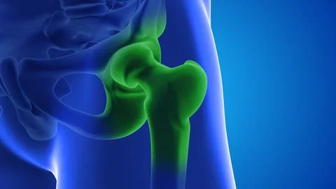 Injecting stem cells into a human thighs Stock Illustration