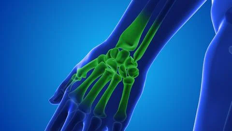 Injecting stem cells into a human wrist Stock Illustration