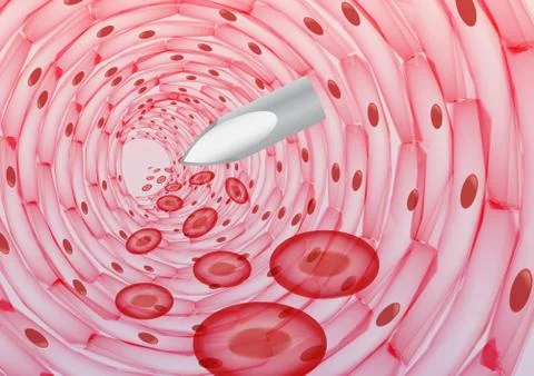 Injection in the Bloodstream  - Vector Illustratio Stock Illustration