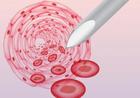 Injection in the Bloodstream  Vector Illustration Stock Illustration