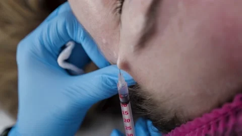 Injection Botox Needle Syringe under the Woman Face Skin, tightening Procedure Stock-Footage 236826620
