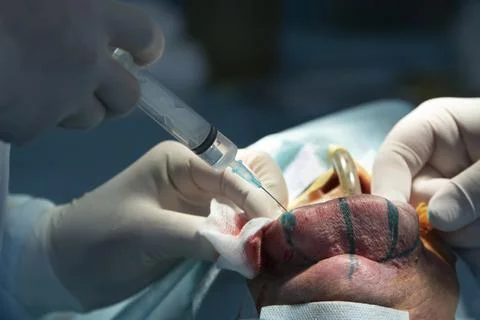 Injection Into Lip Close-up Фото