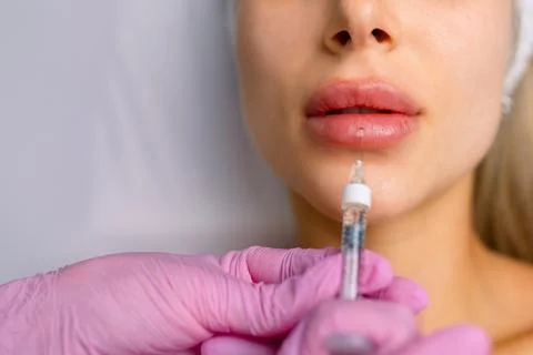 Injection procedure for lip augmentation, close-up. The cosmetologist slowly and Stock Photos
