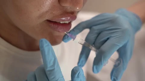 Injection procedure for lip augmentation. Cosmetologist injects filler into lips Video stock 289188962