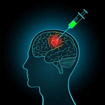 The injection syringe to the brain Stock Illustration