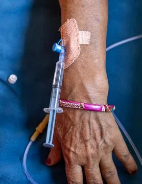 Injection thorough cannula inserted in patients hand during daytime indoors Stock Photos