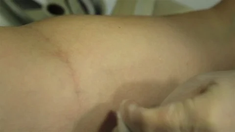 Injection in a vein in the arm Stock Footage 71101380