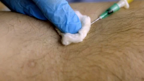 Injection into a vein. Dropper. Stockbeeldmateriaal 265854643