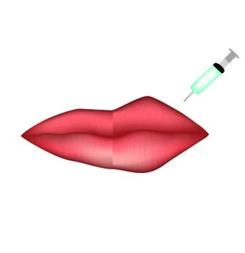 Injections for lip augmentation. Botox. Lips before and after cosmetic procedure Stock Illustration