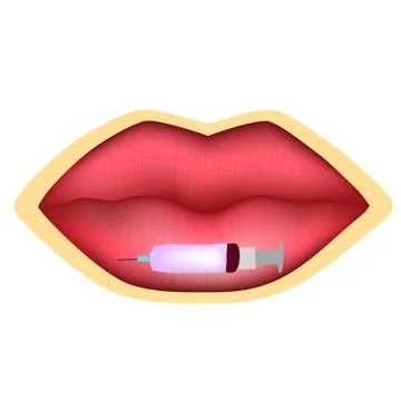 Injections for lip augmentation. Botox. Lips before and after cosmetic procedure Stock Illustration