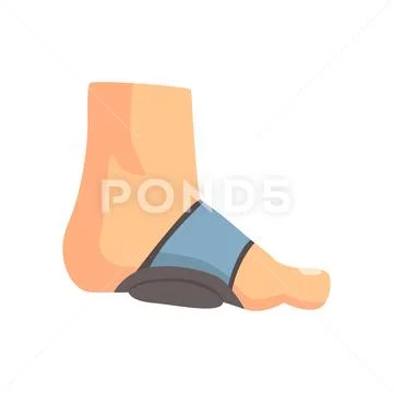 Injured foot bandaged with blue plaster cartoon vector Illustration Stock Illustration