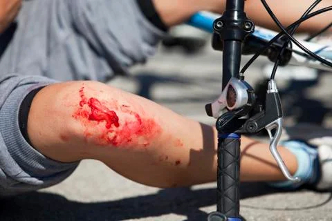Injuries Foto stock