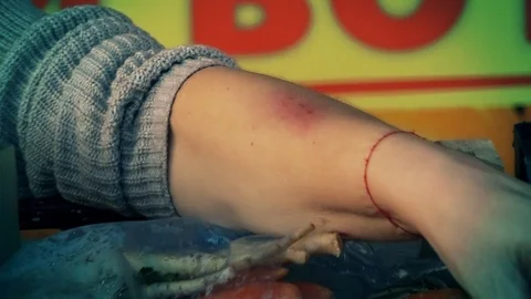 Injuries on a woman's hand Stock-Footage 88324520