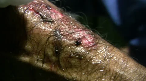 Injury 스톡 동영상 9417265