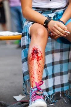 Injury Foto stock