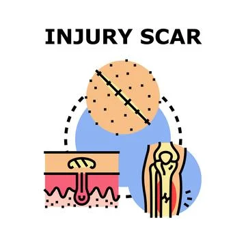 Injury scar healing process causing skin damage concept Stock Illustration